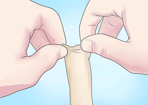 Địa chỉ cắt bao quy đầu ở Hải Phòng