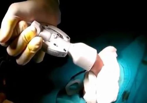 Tư vấn cắt bao quy đầu Hải Phòng