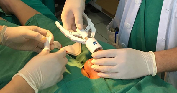 Bảng giá cắt bao quy đầu tại Hải Phòng